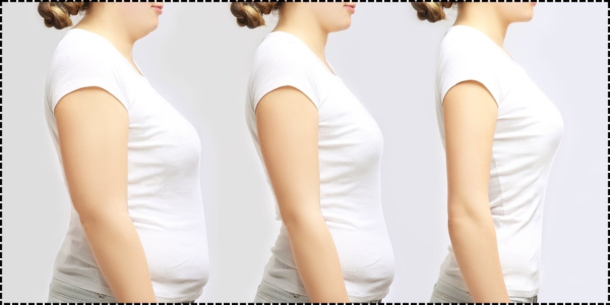 Bariatric Surgery for Weight Loss - Healix Hospitals