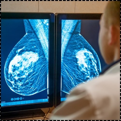 Cancer Screenings - Healix Hospitals