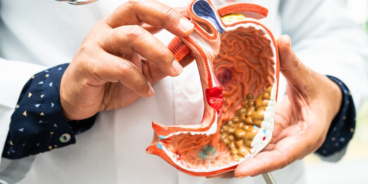 Gastrointestinal Health - Healix Hospitals